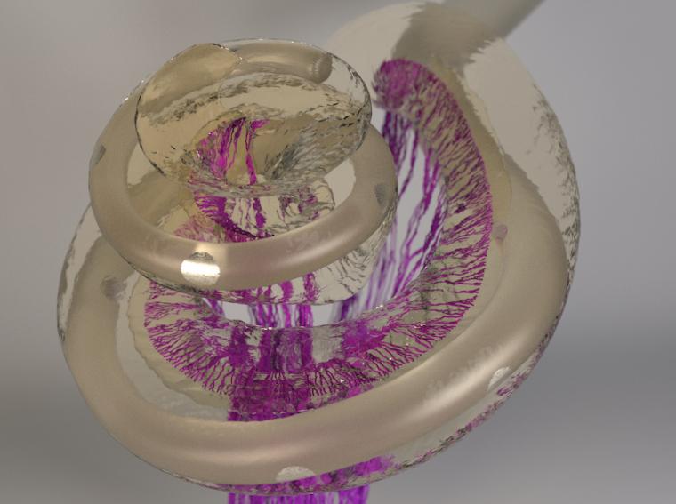 3D image of the human inner ear with an inserted cochlear implant electrode,...