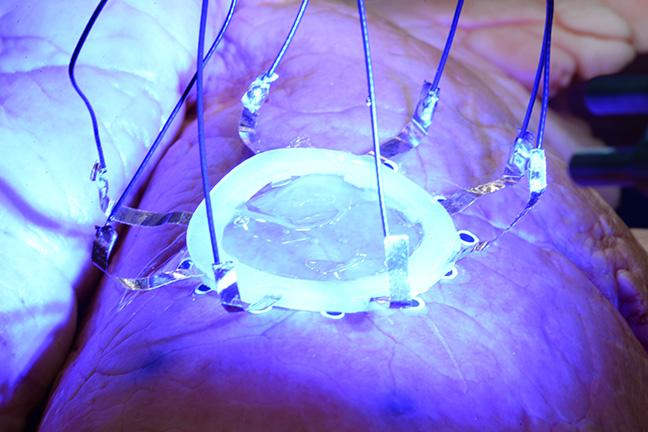 The new technique allows 3D printing of hydrogel-based sensors directly on...