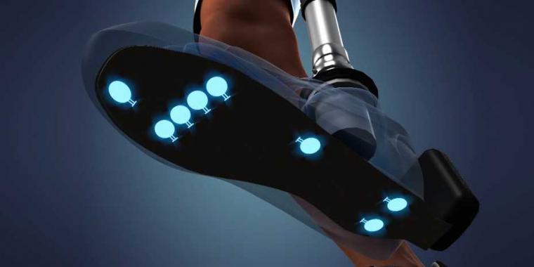 Bionic prosthesis improves amputees’ health