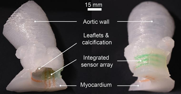 Patient-specific organ models, which include integrated 3D-printed soft sensor...