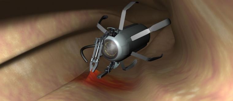 Tiny medical implant from the Versatile Endoscopic Capsule for gastrointestinal...