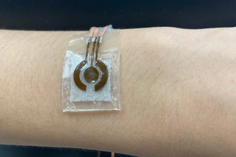 prototype of a wearable, noninvasive glucose sensor, shown on the arm.
